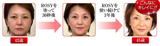 �G�X�e�e�B�b�N�T�����p�̃��t�g�A�b�v�N���[��rosy���i��